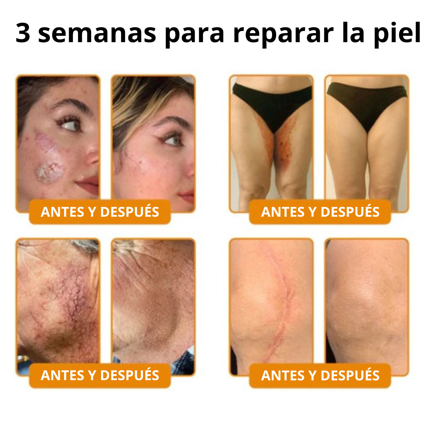 Bee Venom, aclara y suaviza tu piel