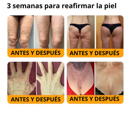 Bee Venom, aclara y suaviza tu piel