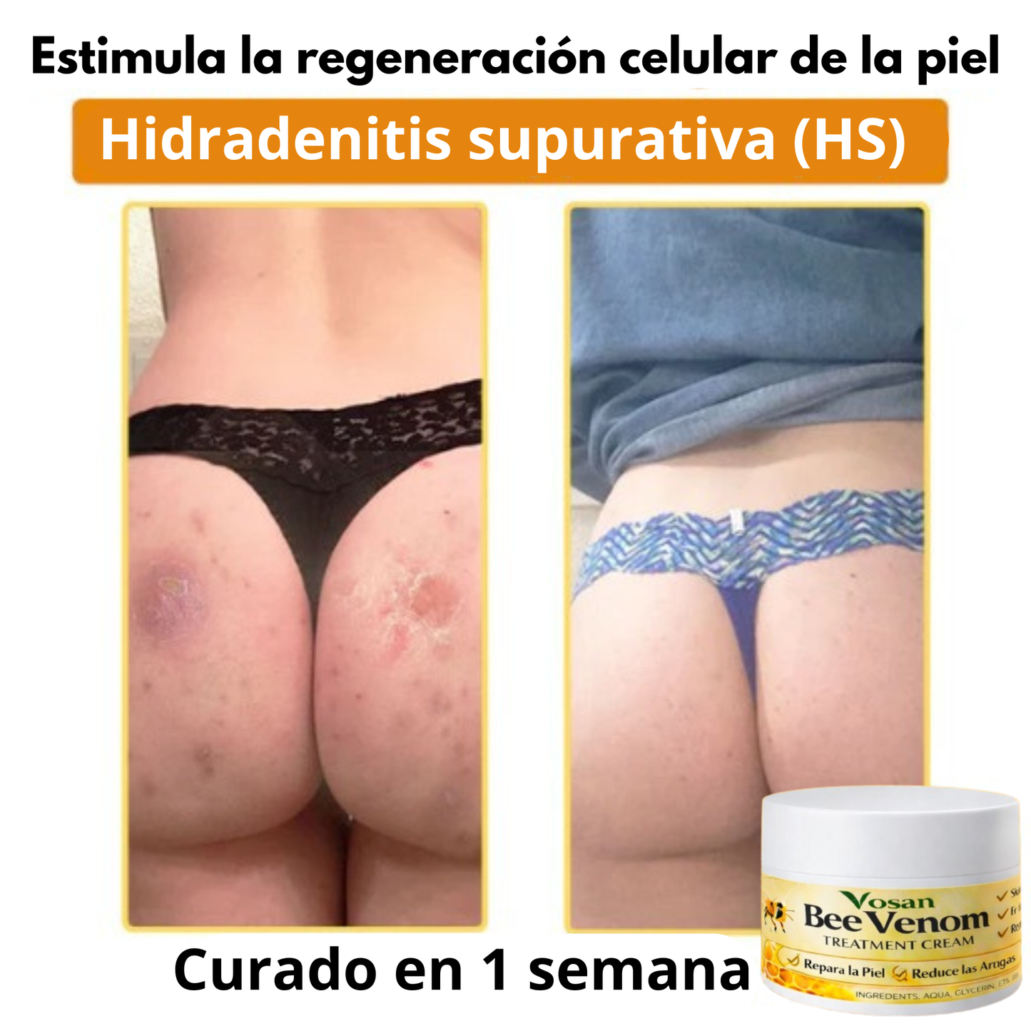 Bee Venom, aclara y suaviza tu piel