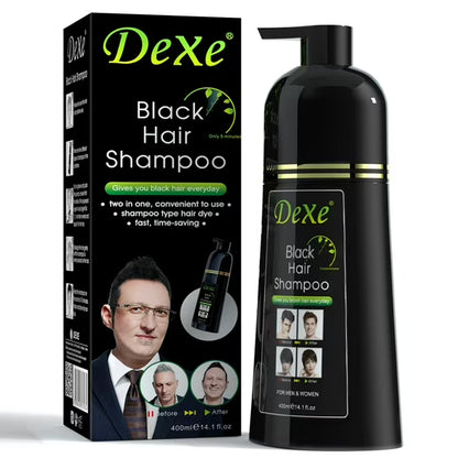 Dexe Hair, adiós canas y caídas del cabello