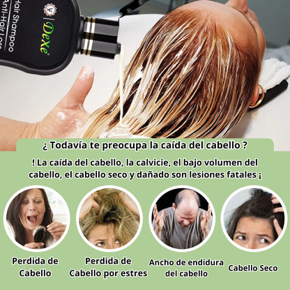 Dexe Hair, adiós canas y caídas del cabello