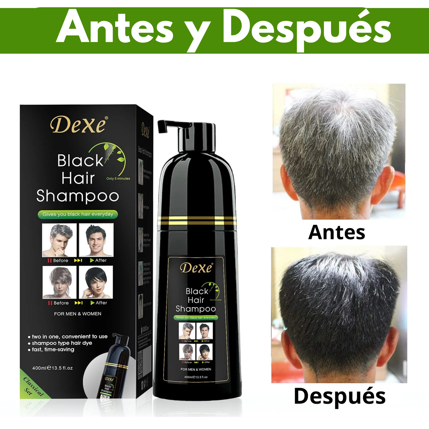 Dexe Hair, adiós canas y caídas del cabello
