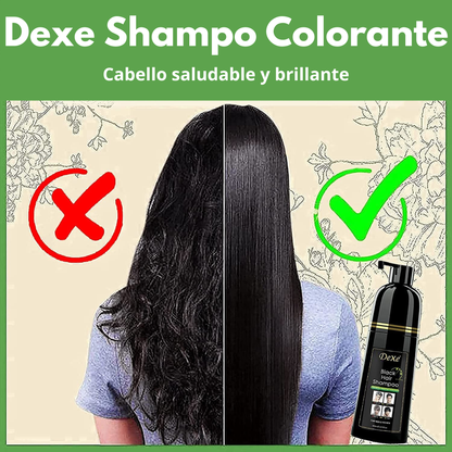 Dexe Hair, adiós canas y caídas del cabello