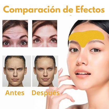 Parche Para La Frente, dile adiós a las Arrugas